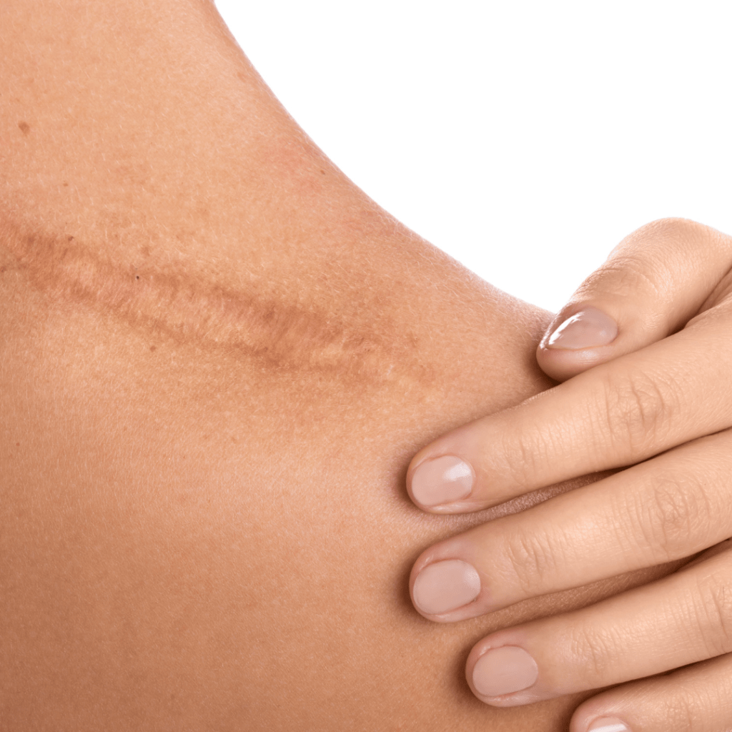 plastic surgery (1400 x 580 px) (Post de Instagram) (6)