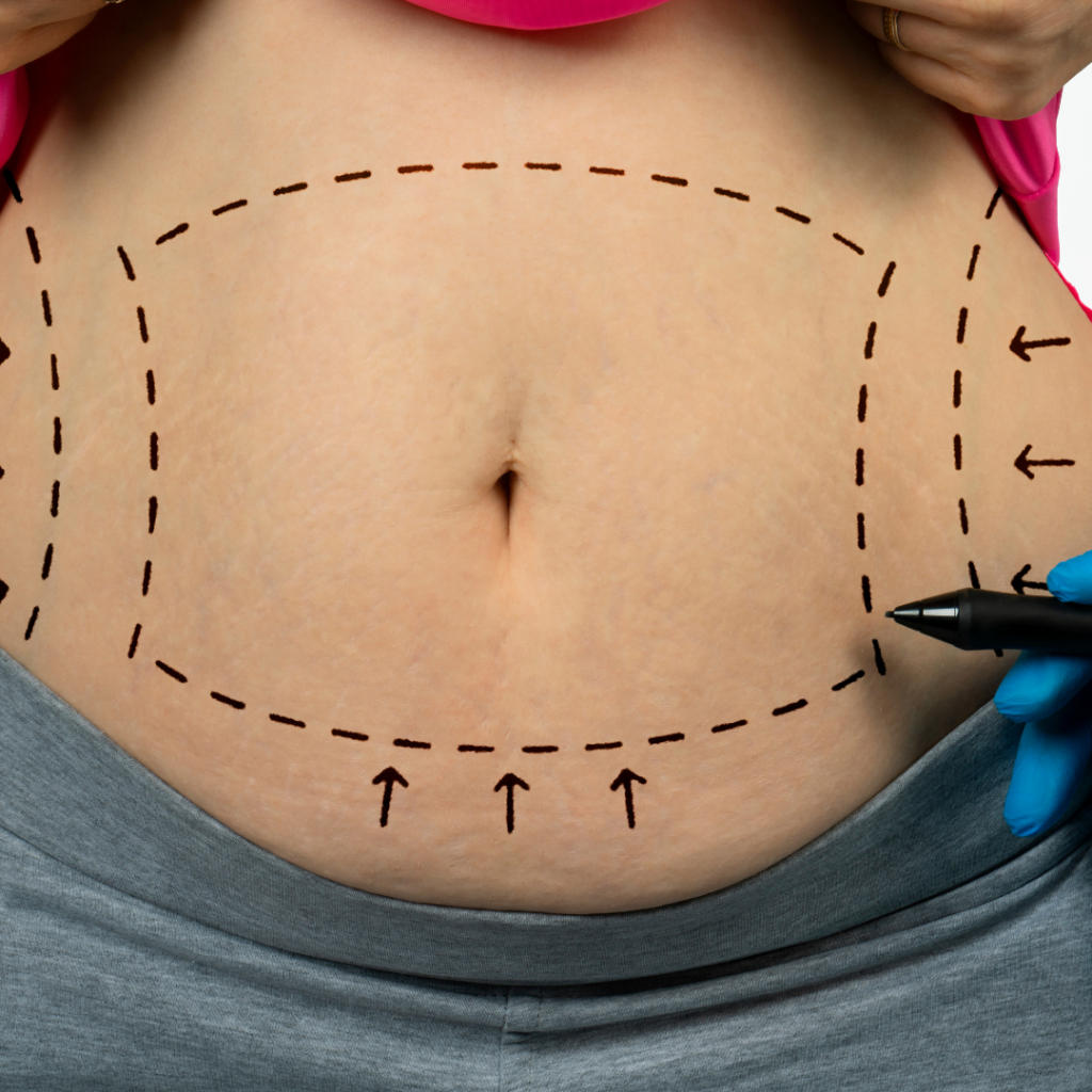 plastic surgery (1400 x 580 px) (Post de Instagram) (1)