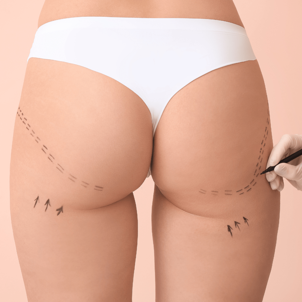 plastic surgery (1400 x 580 px) (Post de Instagram) (28)