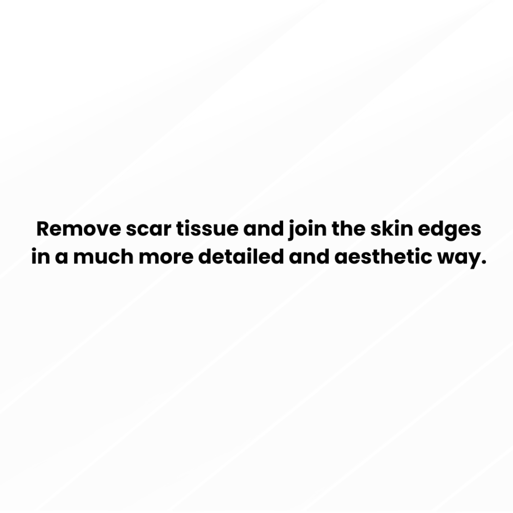 plastic surgery (1400 x 580 px) (Post de Instagram) (49)